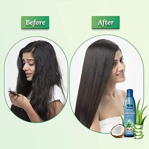 Parachute Advansed Aloevera Hair Oil - Before After Image